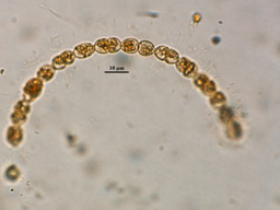Anabaena, Lugol's preserved, Auburn University pond