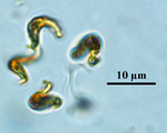 Ankistrodesmus, Lugol's preserved, Auburn University pond