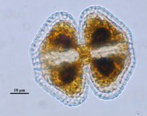 Cosmarium, Lugol's preserved, Auburn University pond