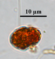 Gymnodenium, Lugol's preserved, Auburn University pond