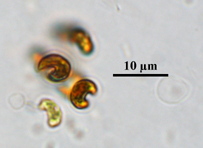 Kirchneriella, Lugol's preserved, Auburn University pond