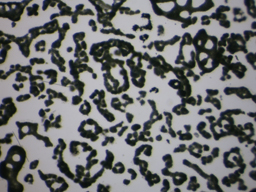 Microcystis, Lugol's preserved, Auburn University pond