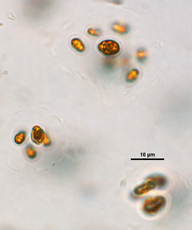 Oocystis, Lugol's preserved, Auburn University pond
