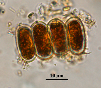 Scenedesmus, Lugol's preserved, Auburn University pond