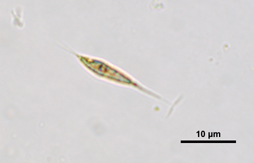 Schroederia, Lugol's preserved, Auburn University pond