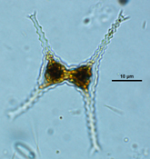 Staurastrum, Lugol's preserved, Auburn University pond
