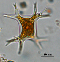 Tetraedron, Lugol's preserved, Auburn University pond